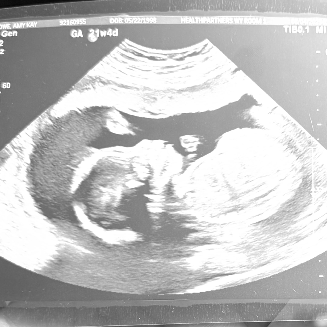 Photo shared by Amy for their Babylist baby registry.