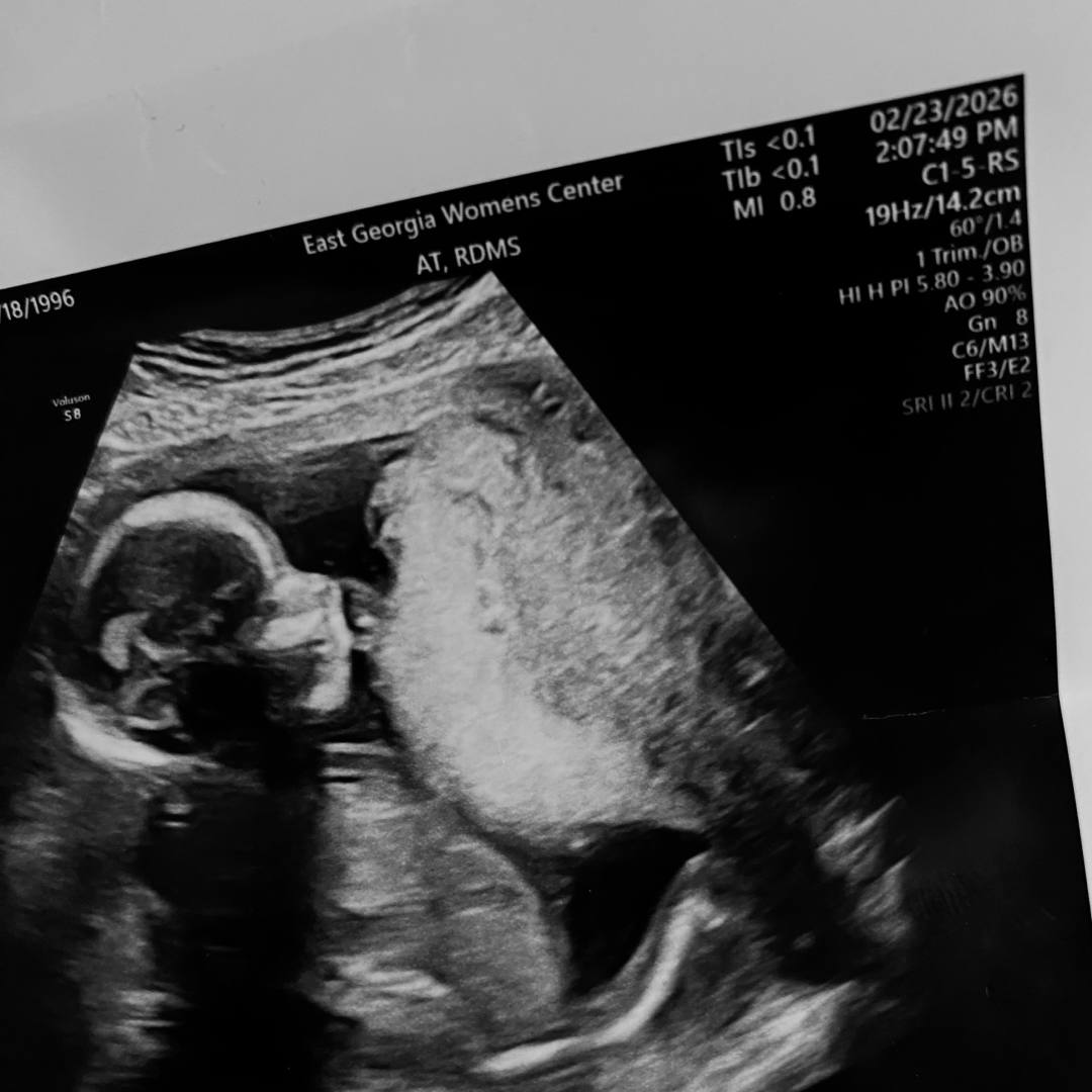 Photo shared by Dyamond for their Babylist baby registry.