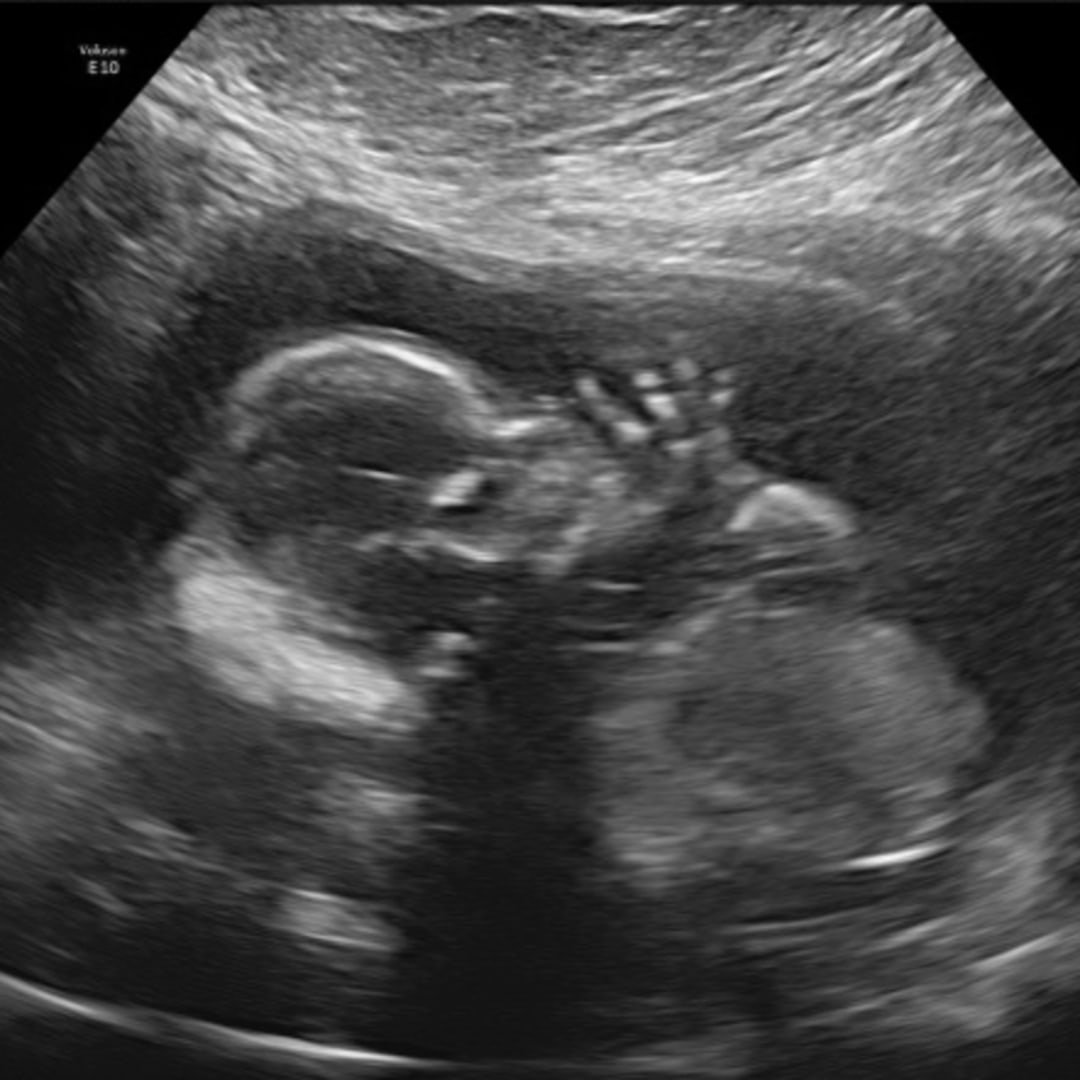 Photo shared by Paige for their Babylist baby registry.