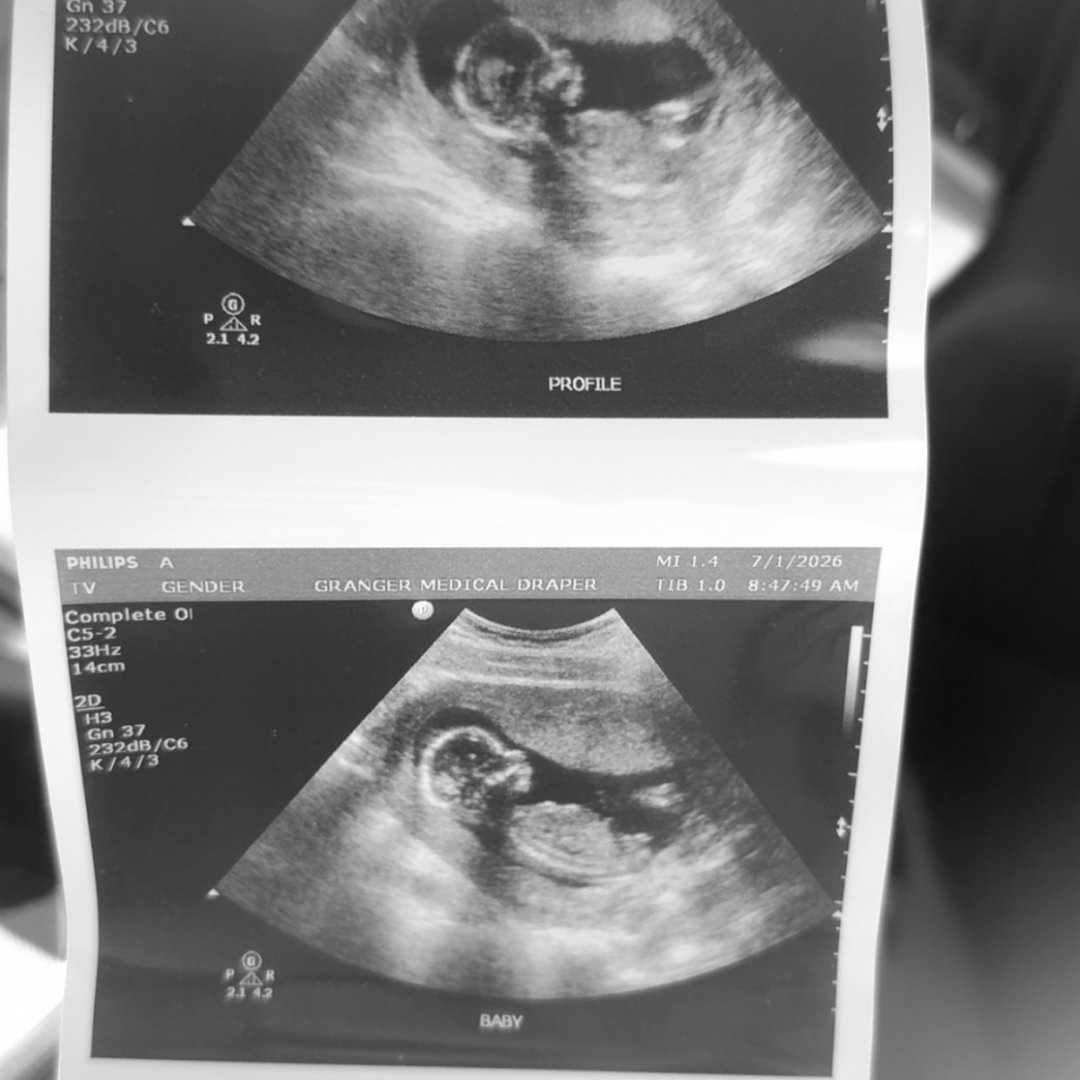 Photo shared by Annika for their Babylist baby registry.