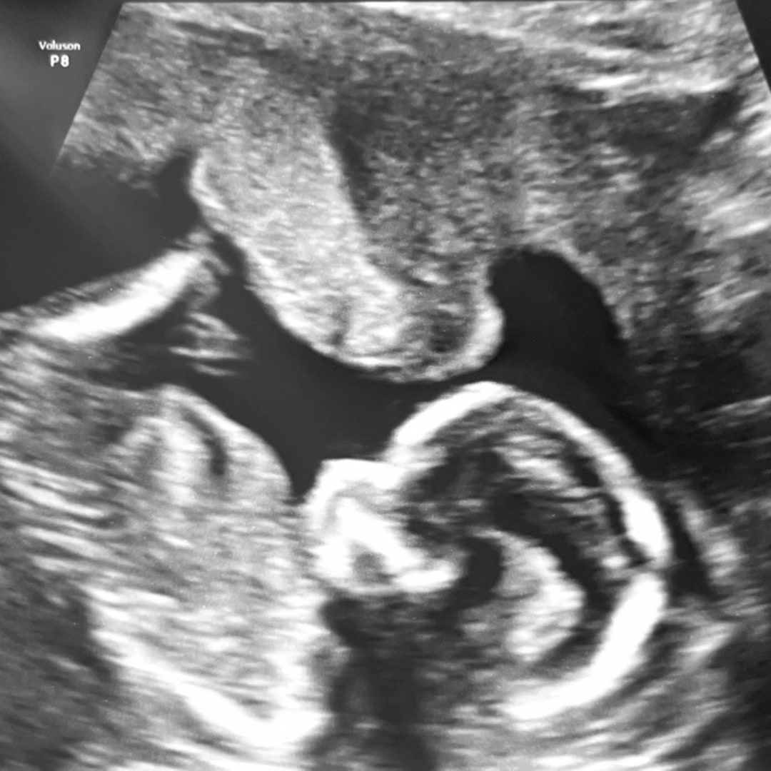 Photo shared by Dayna for their Babylist baby registry.