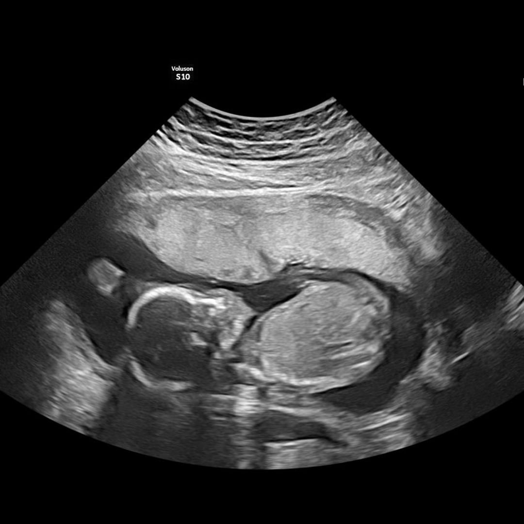 Photo shared by Tate for their Babylist baby registry.