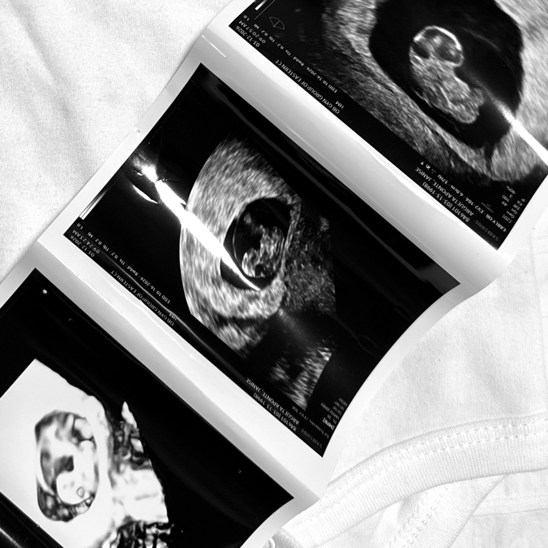 Photo shared by Janise for their Babylist baby registry.