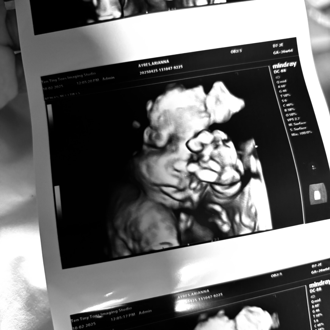 Photo shared by Arianna for their Babylist baby registry.