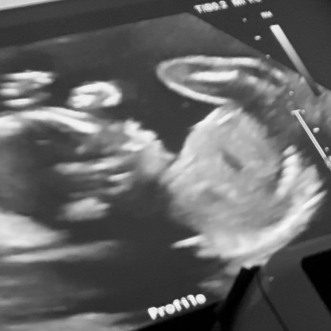 Photo shared by Alora for their Babylist baby registry.