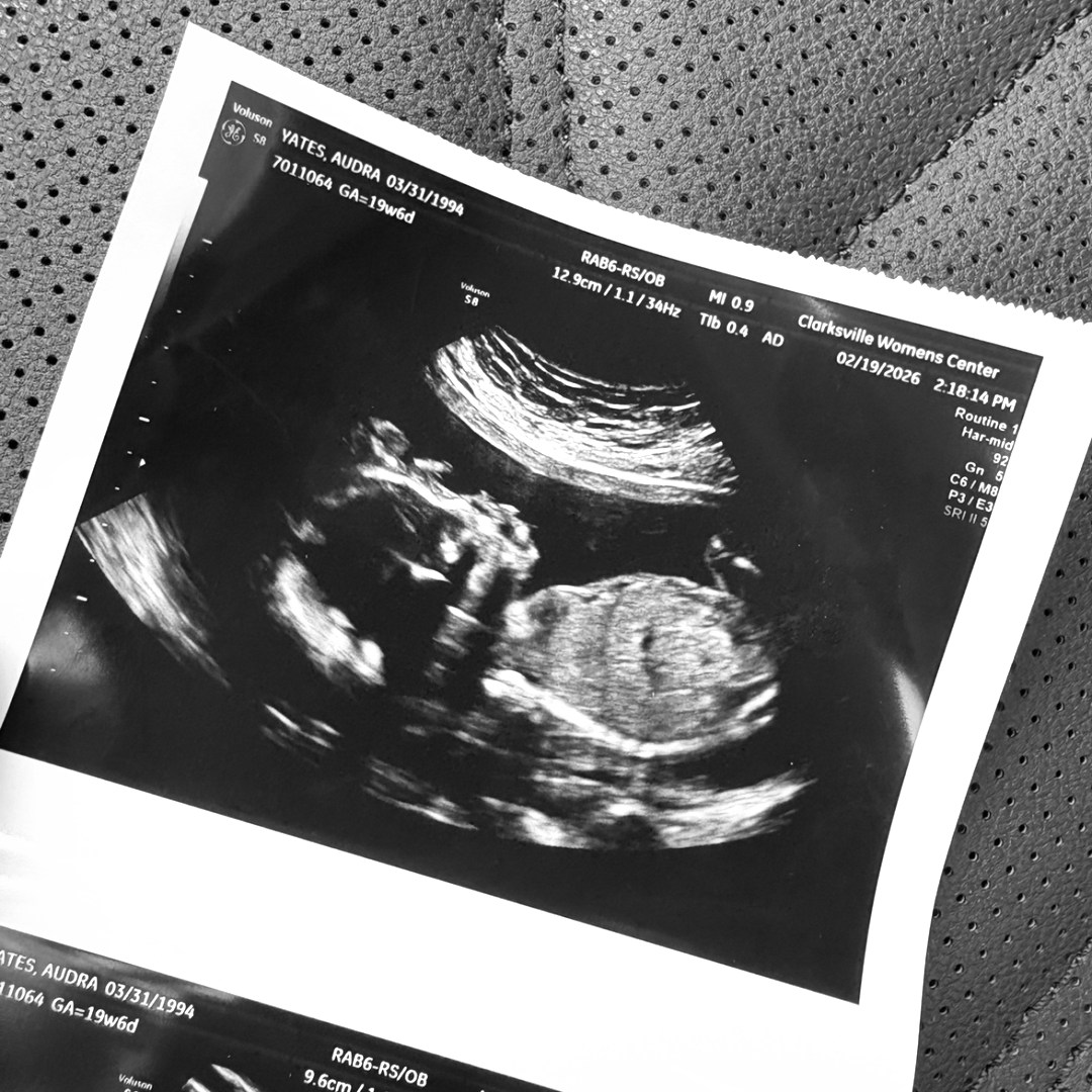 Photo shared by Audra for their Babylist baby registry.