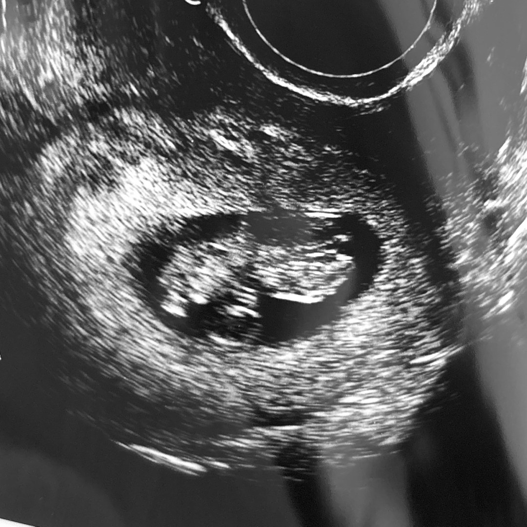 Photo shared by Chloe for their Babylist baby registry.