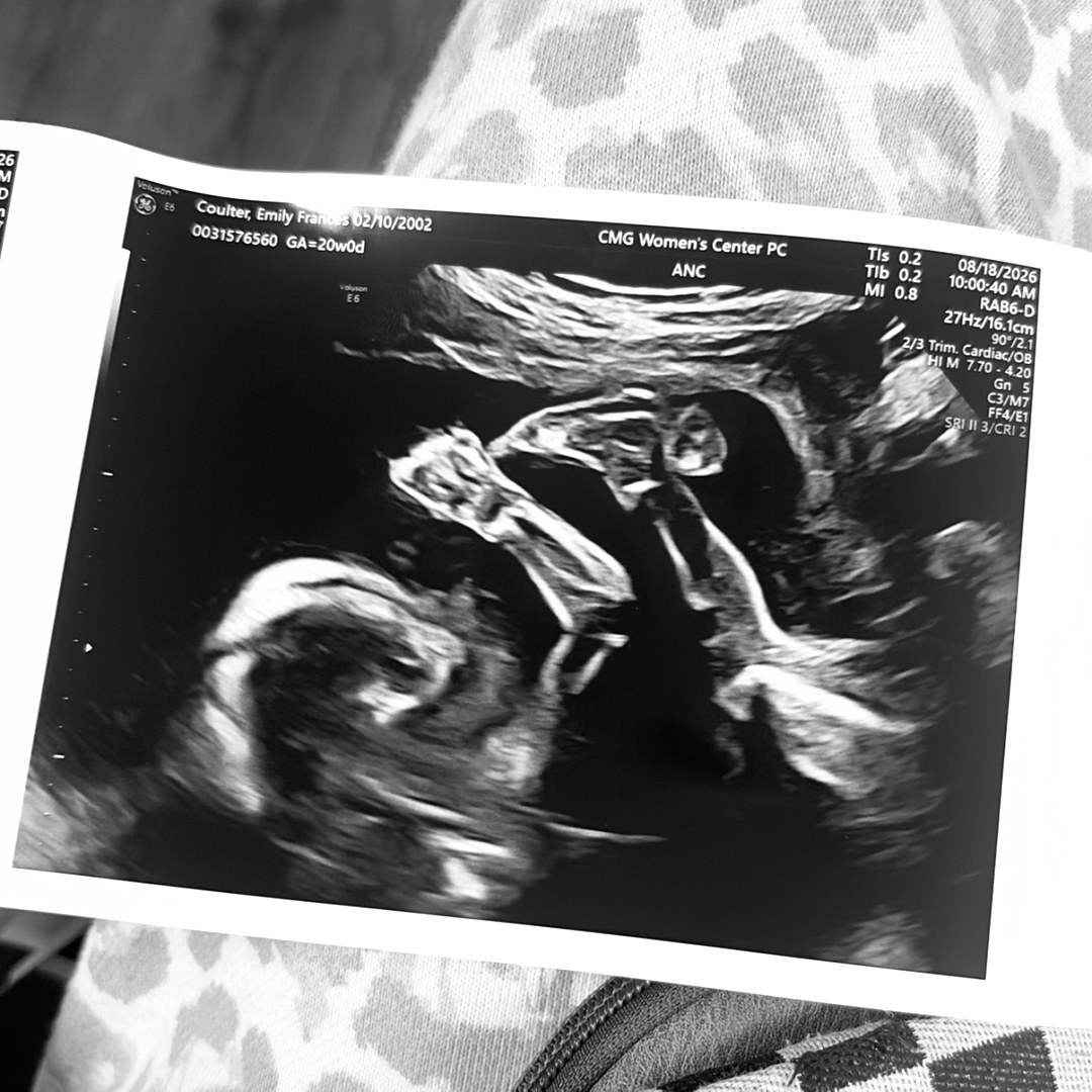 Photo shared by Emily for their Babylist baby registry.