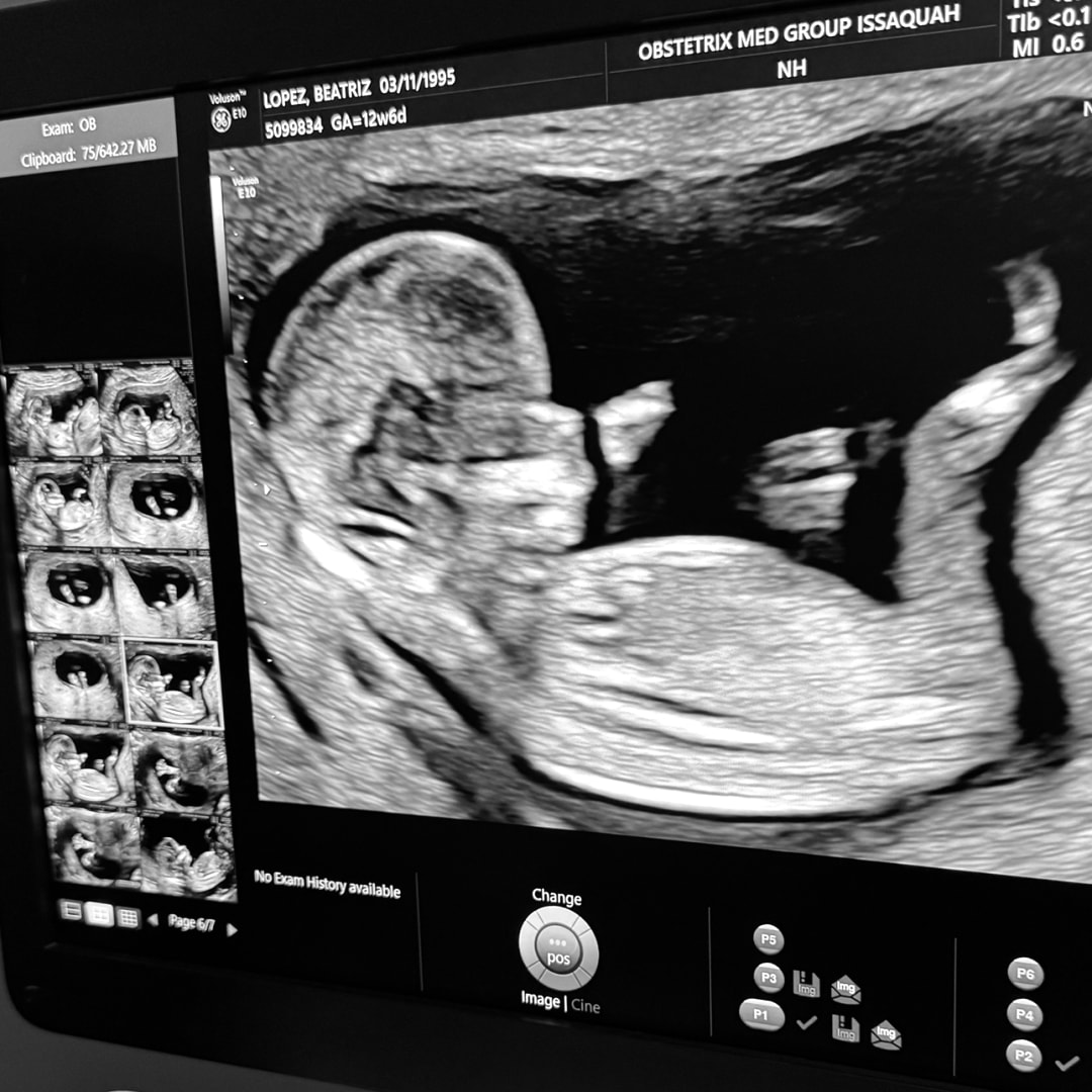 Photo shared by Betty for their Babylist baby registry.