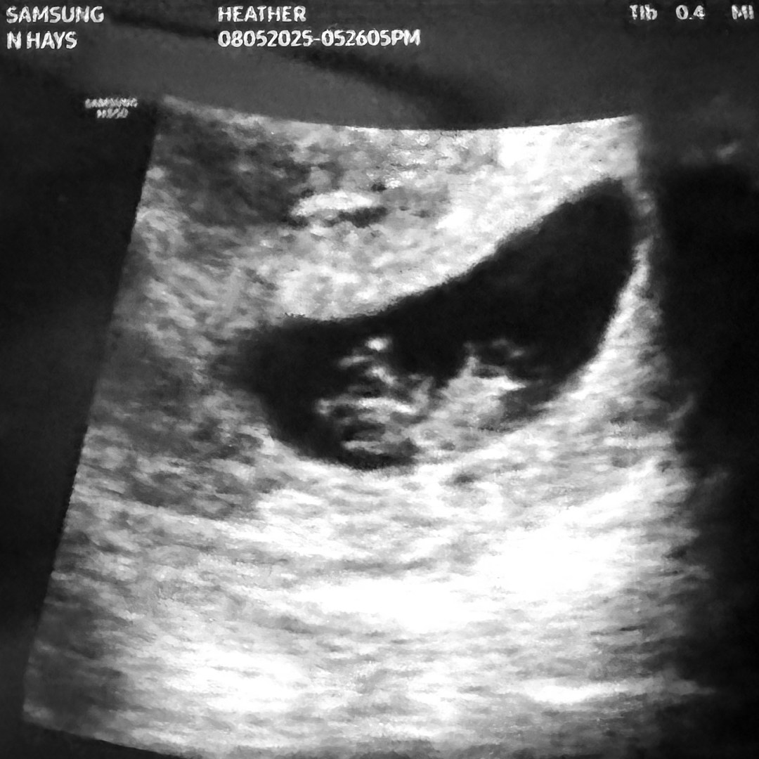 Photo shared by HEATHER for their Babylist baby registry.