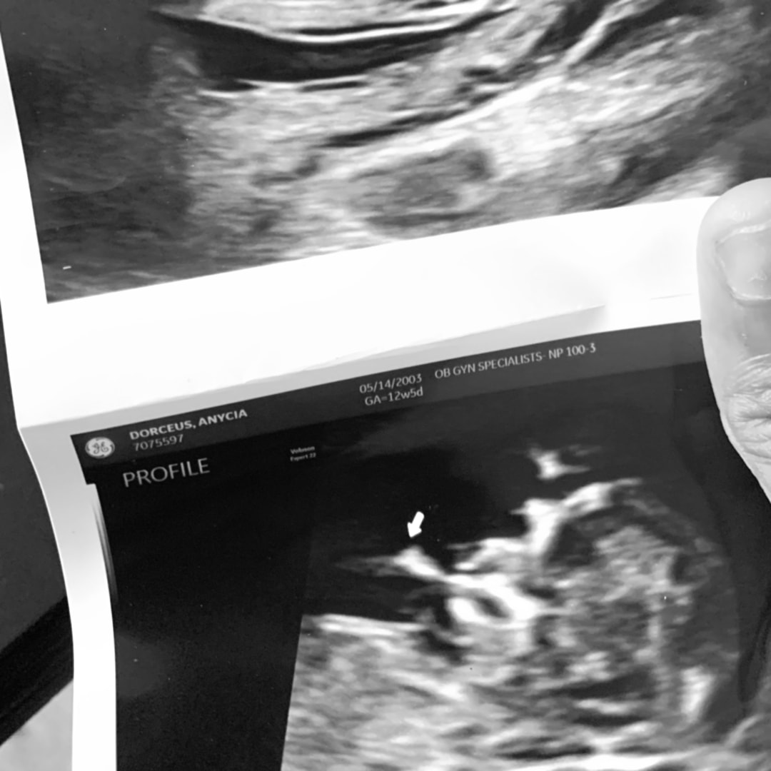 Photo shared by Anycia for their Babylist baby registry.