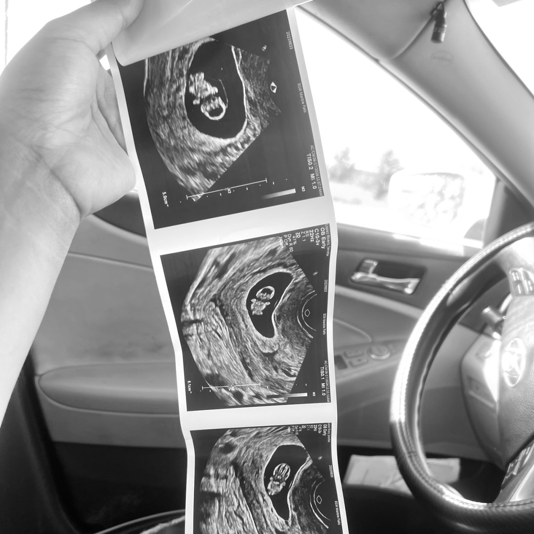 Photo shared by Jenny for their Babylist baby registry.