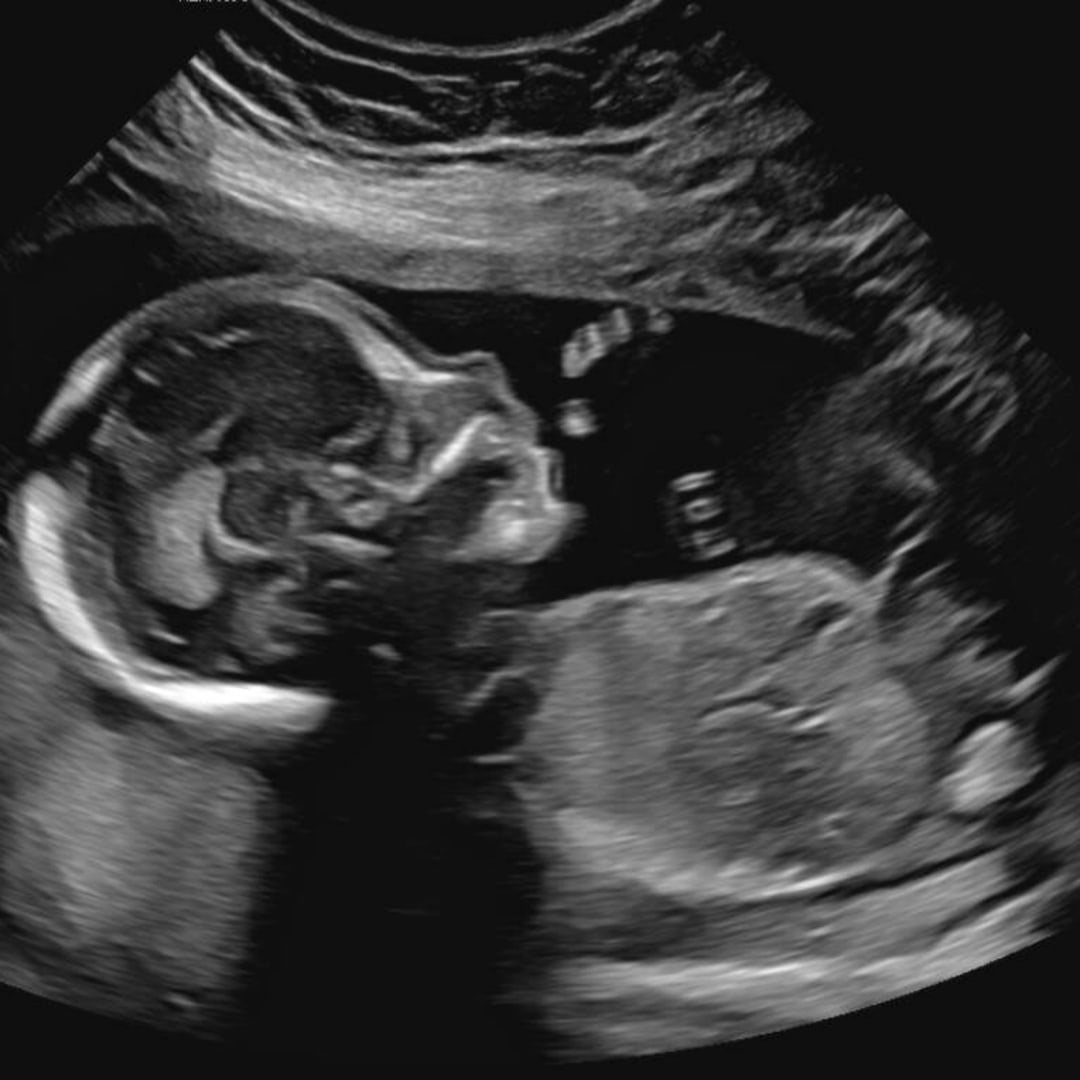 Photo shared by Jenna for their Babylist baby registry.