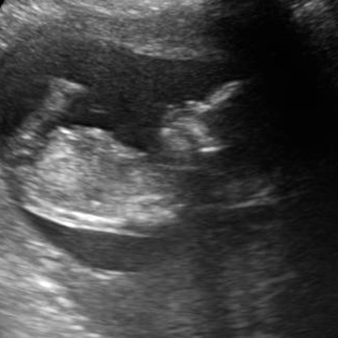 Photo shared by Stephanie for their Babylist baby registry.
