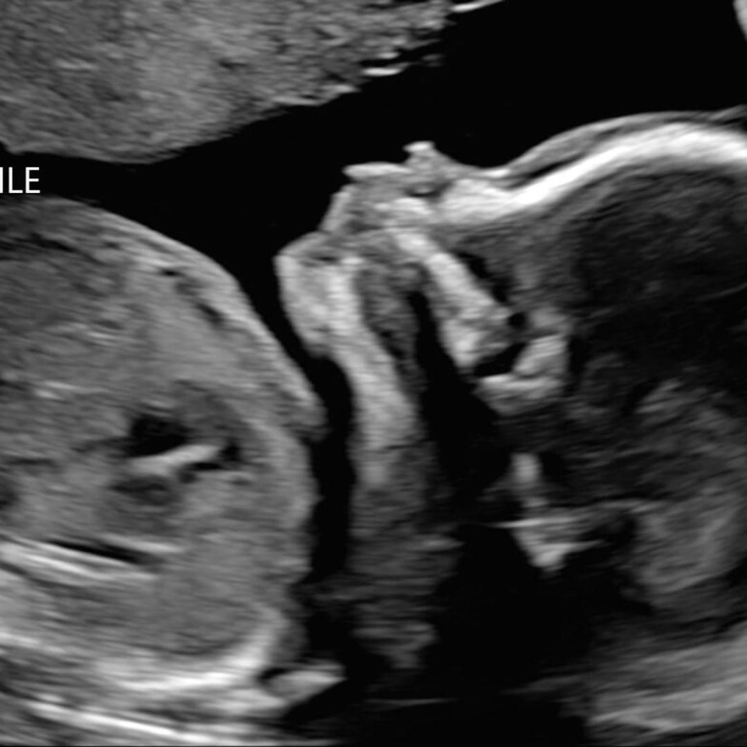 Photo shared by Jaqueline for their Babylist baby registry.