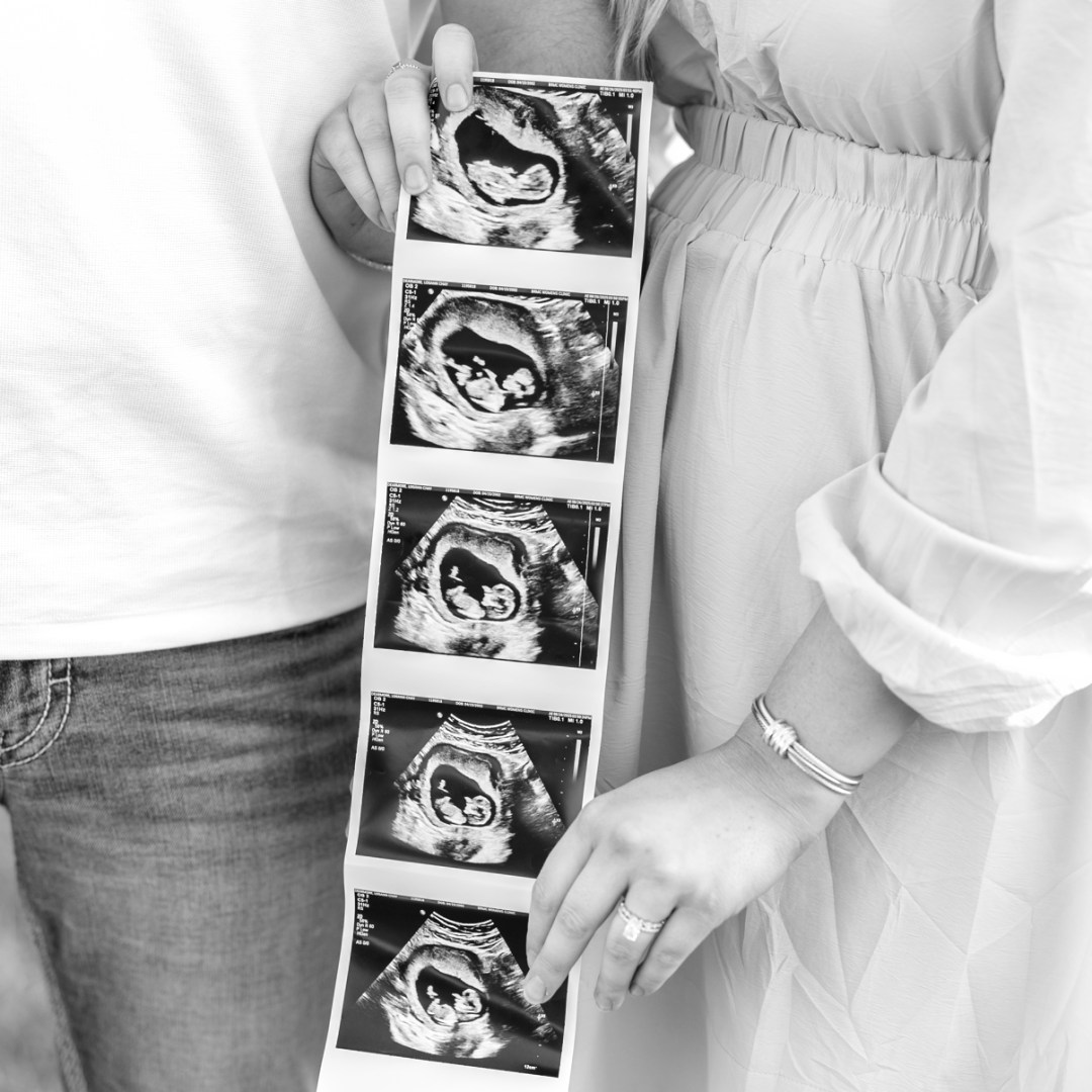 Photo shared by Logann for their Babylist baby registry.