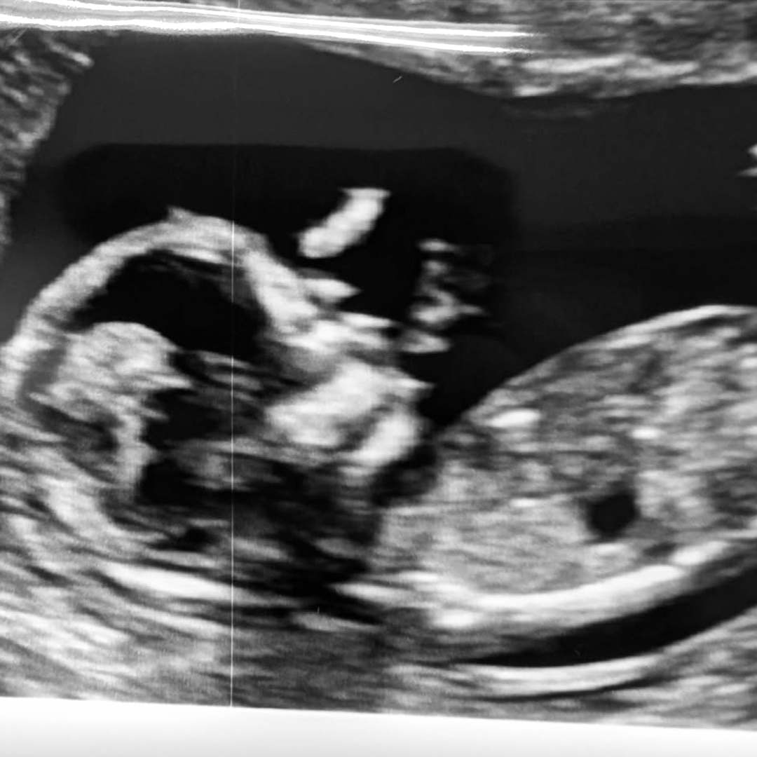 Photo shared by Corwynn for their Babylist baby registry.
