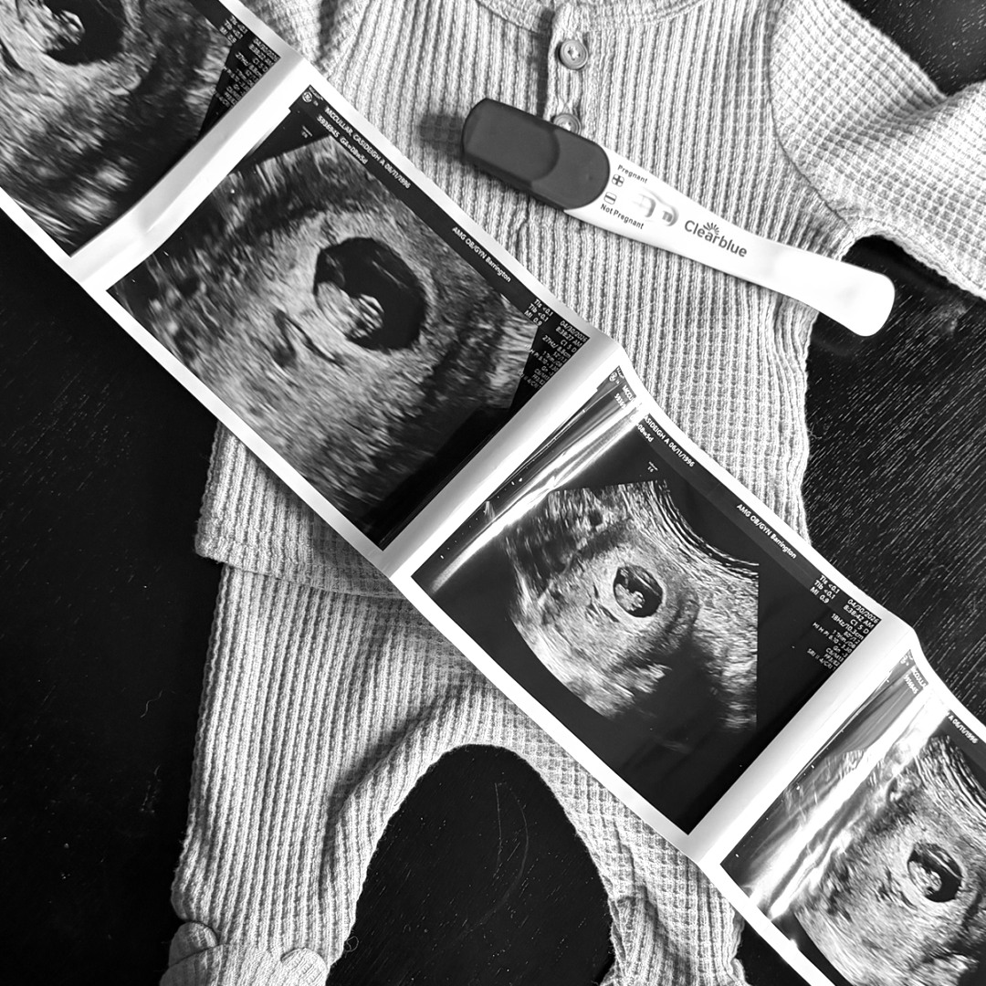 Photo shared by Casideigh for their Babylist baby registry.