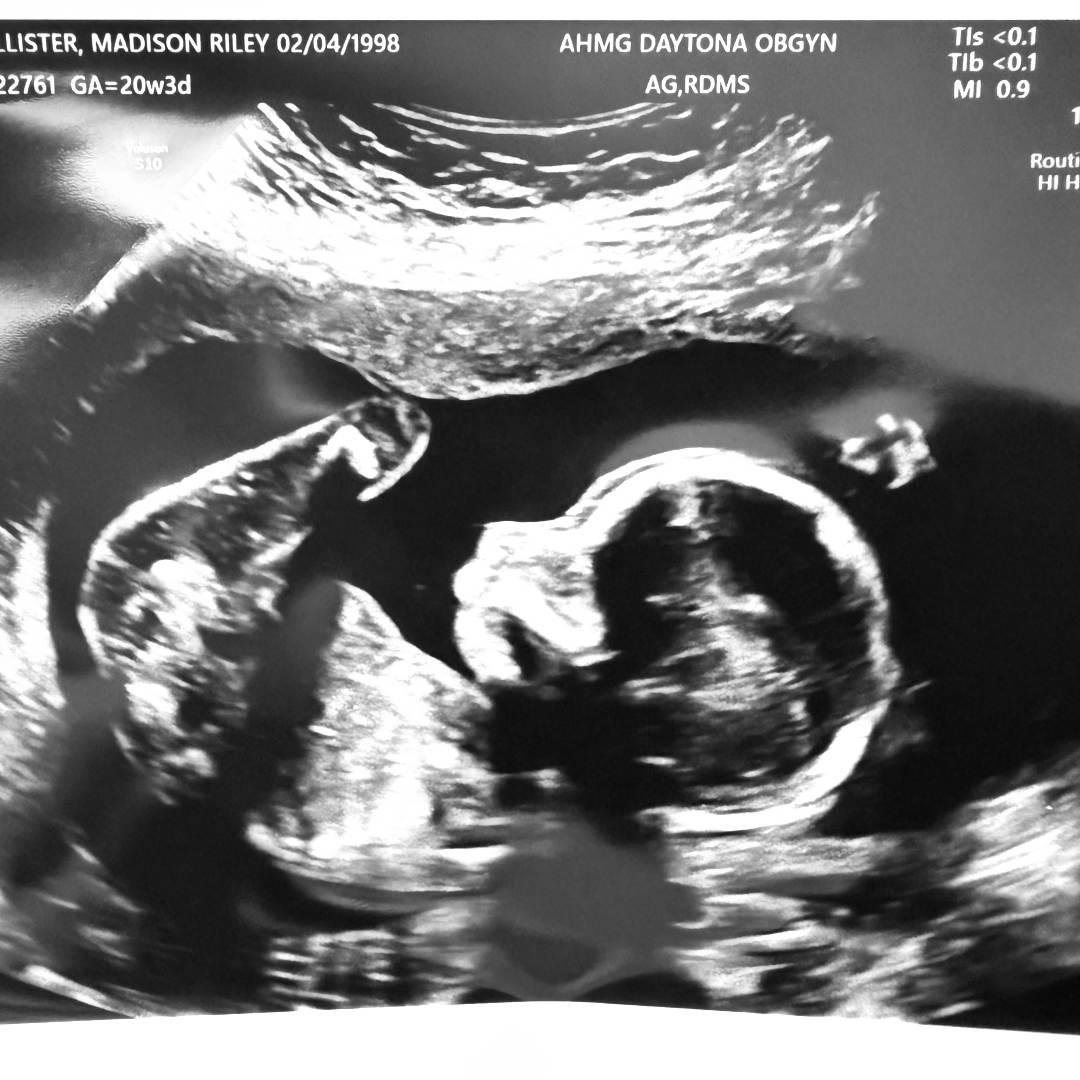 Photo shared by Madison for their Babylist baby registry.