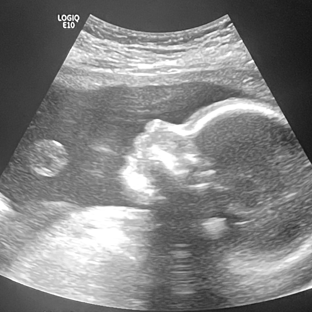 Photo shared by Kaitlin for their Babylist baby registry.