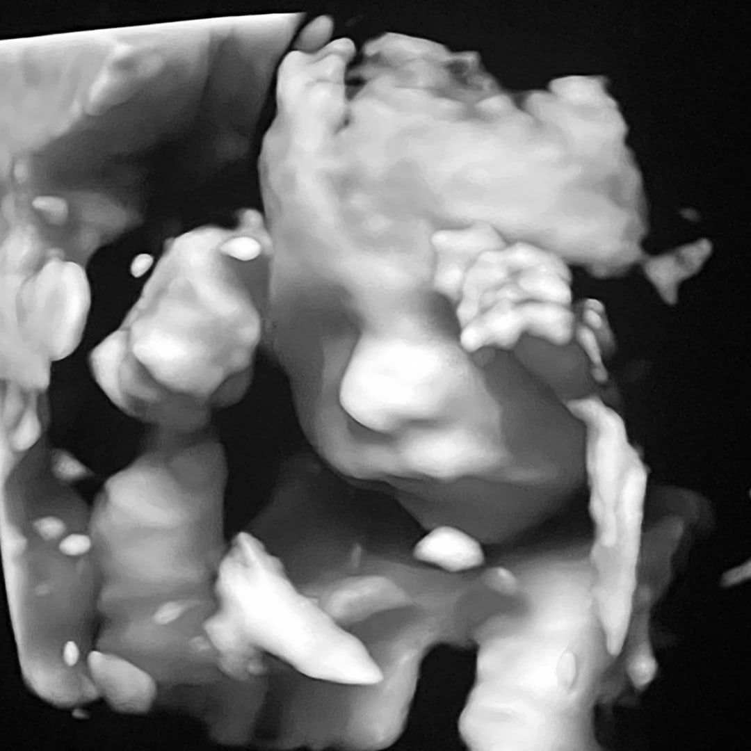 Photo shared by Johi for their Babylist baby registry.