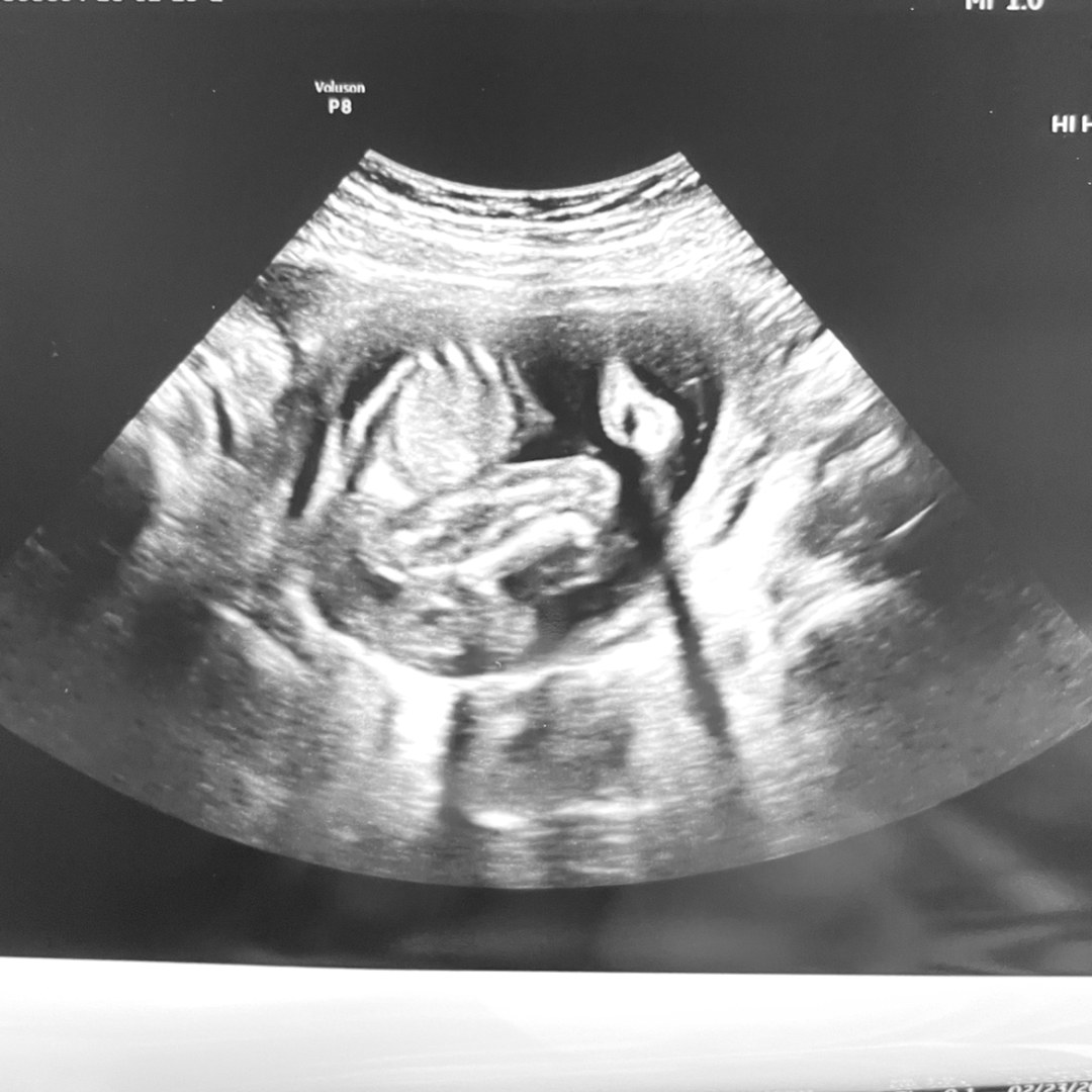 Photo shared by Claudia for their Babylist baby registry.