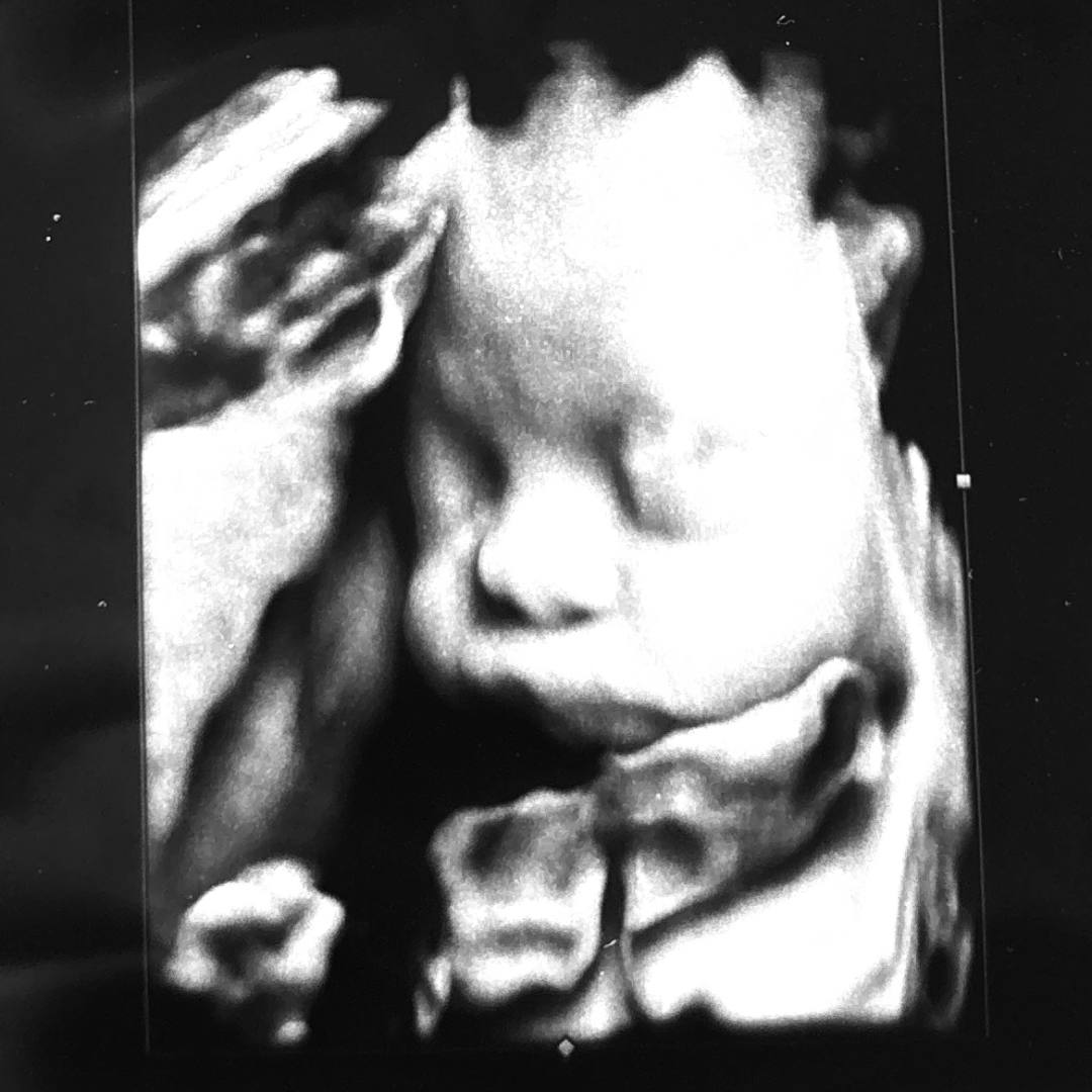 Photo shared by Angel for their Babylist baby registry.