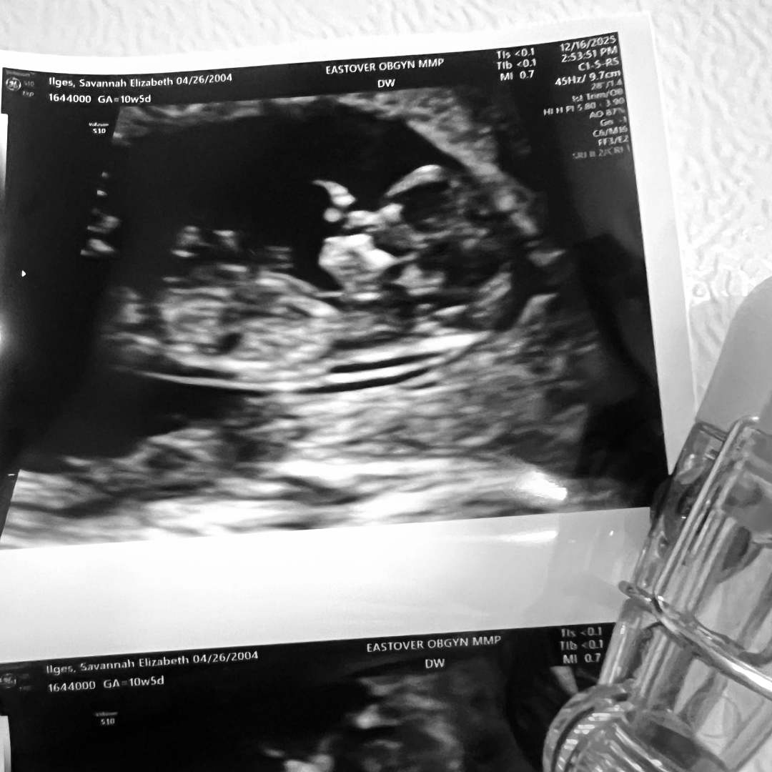 Photo shared by Savannah for their Babylist baby registry.