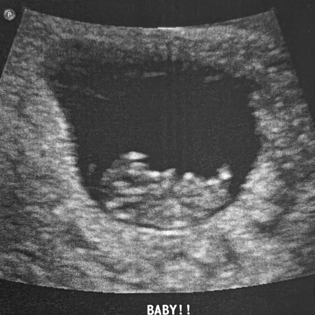 Photo shared by Amy for their Babylist baby registry.