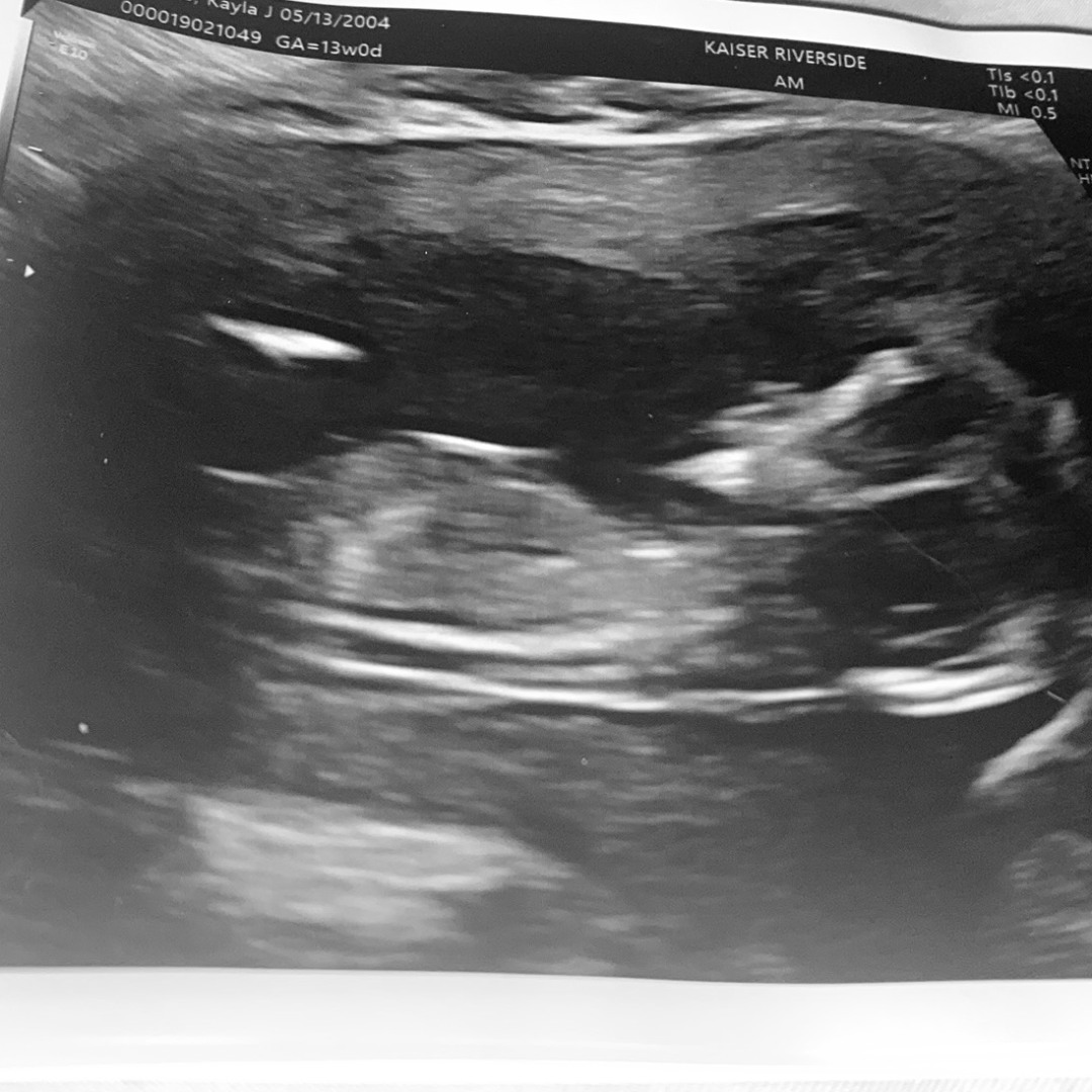 Photo shared by Kayla for their Babylist baby registry.