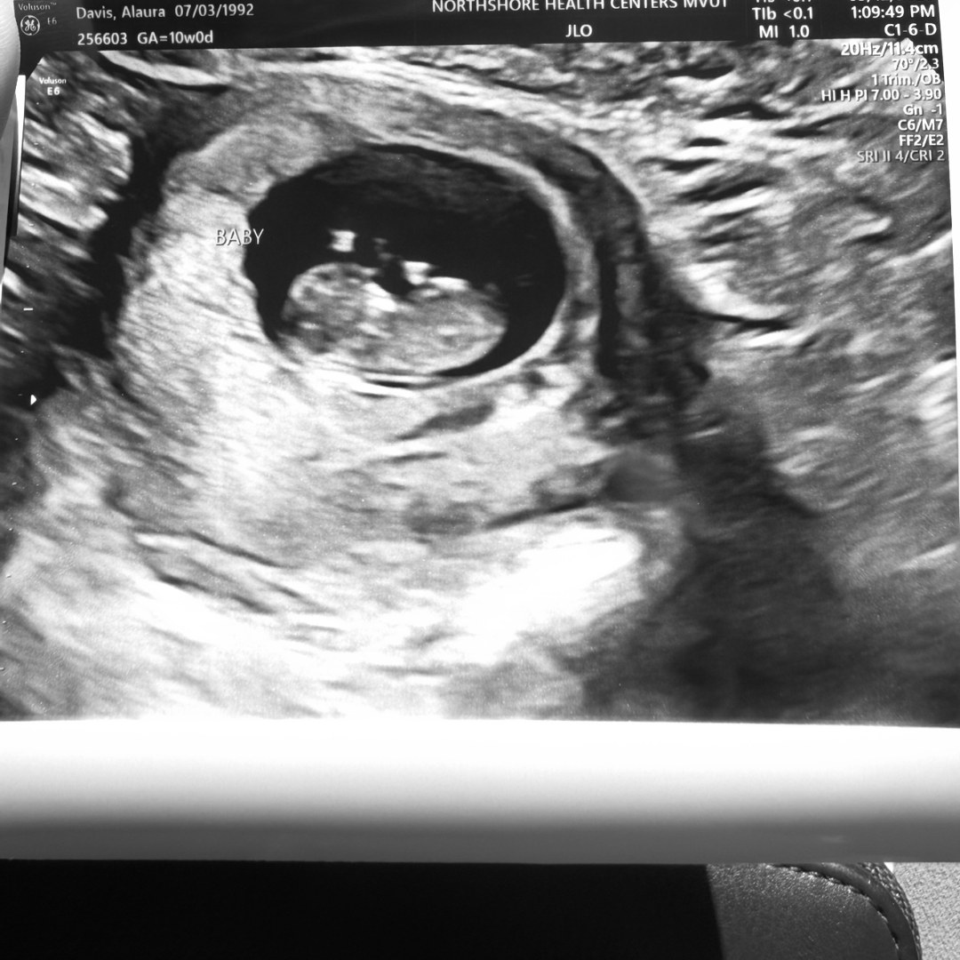 Photo shared by Alaura for their Babylist baby registry.