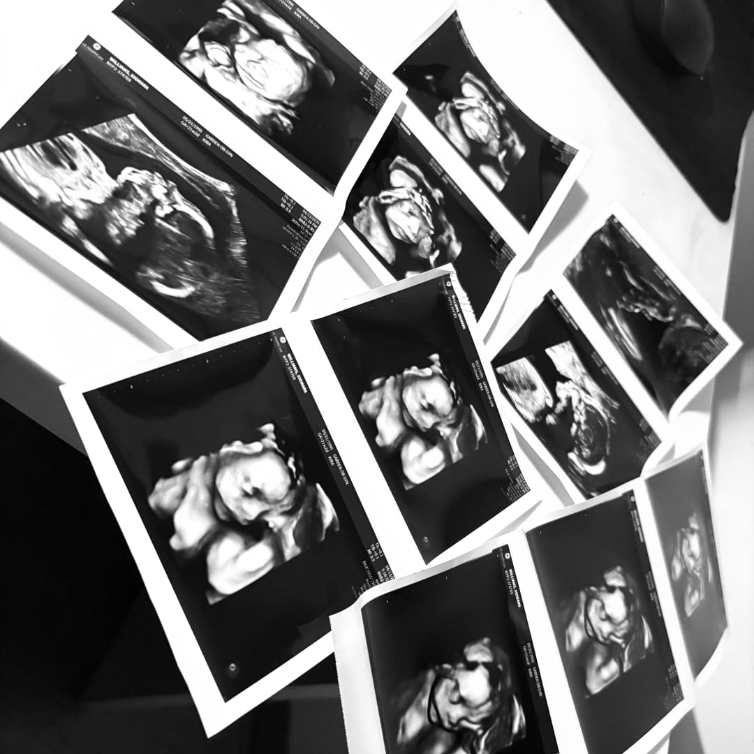 Photo shared by Xiomara for their Babylist baby registry.