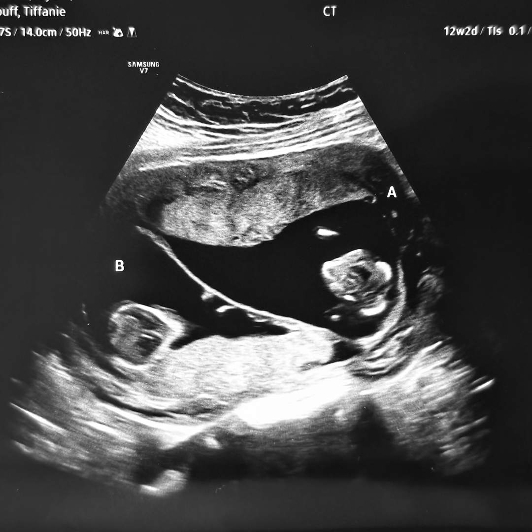 Photo shared by Tiffanie for their Babylist baby registry.