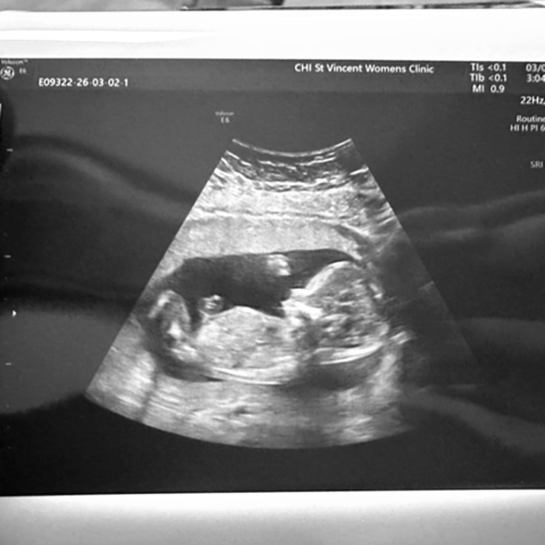 Photo shared by Lannah for their Babylist baby registry.