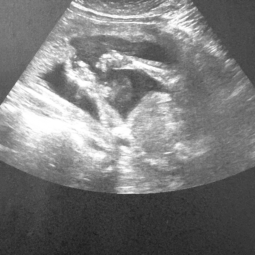Photo shared by Monica for their Babylist baby registry.