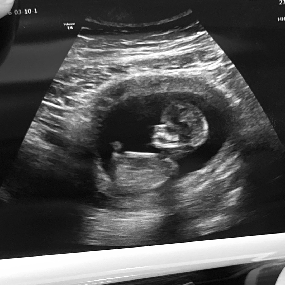 Photo shared by Jahsalyn for their Babylist baby registry.
