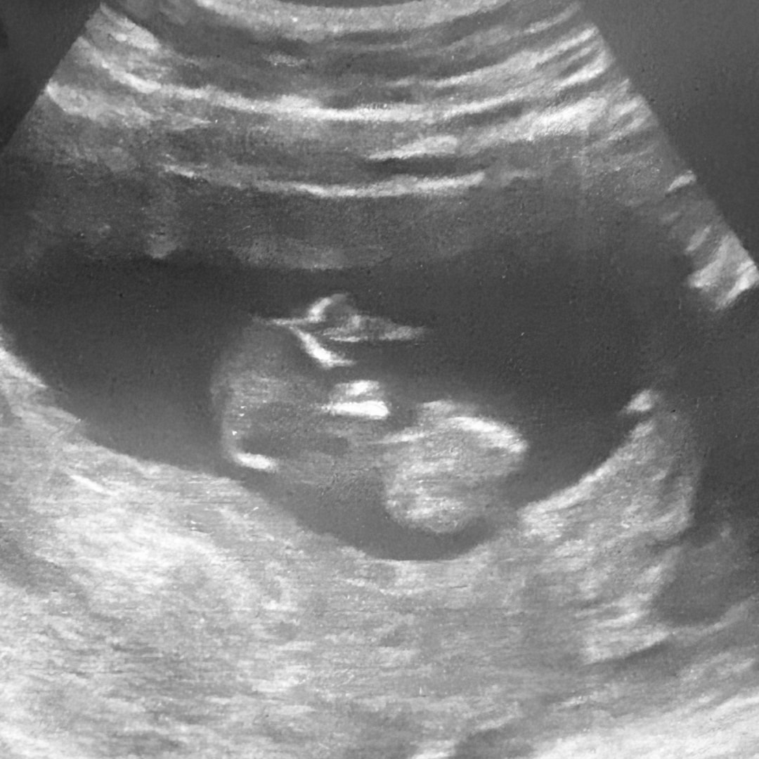 Photo shared by Alicia for their Babylist baby registry.