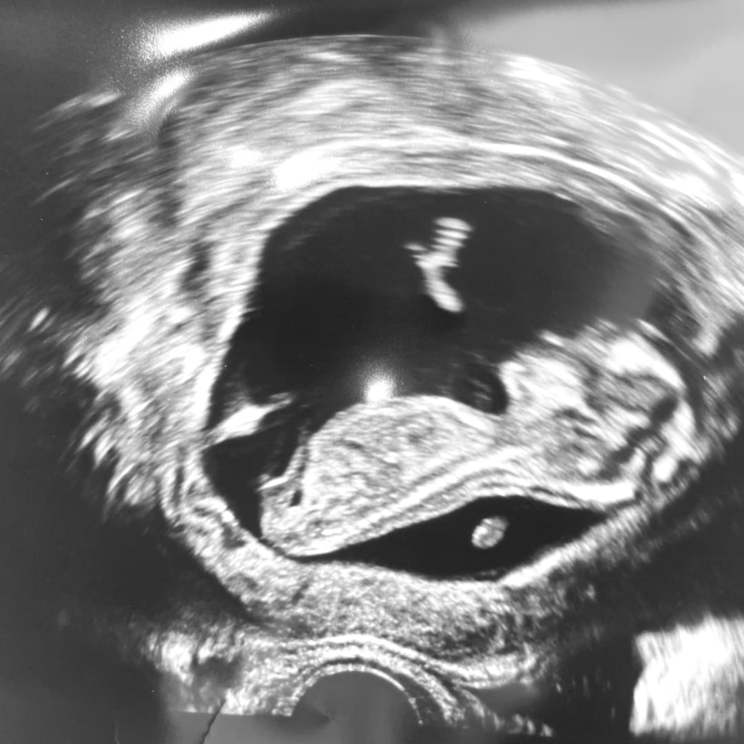 Photo shared by Lindsey for their Babylist baby registry.