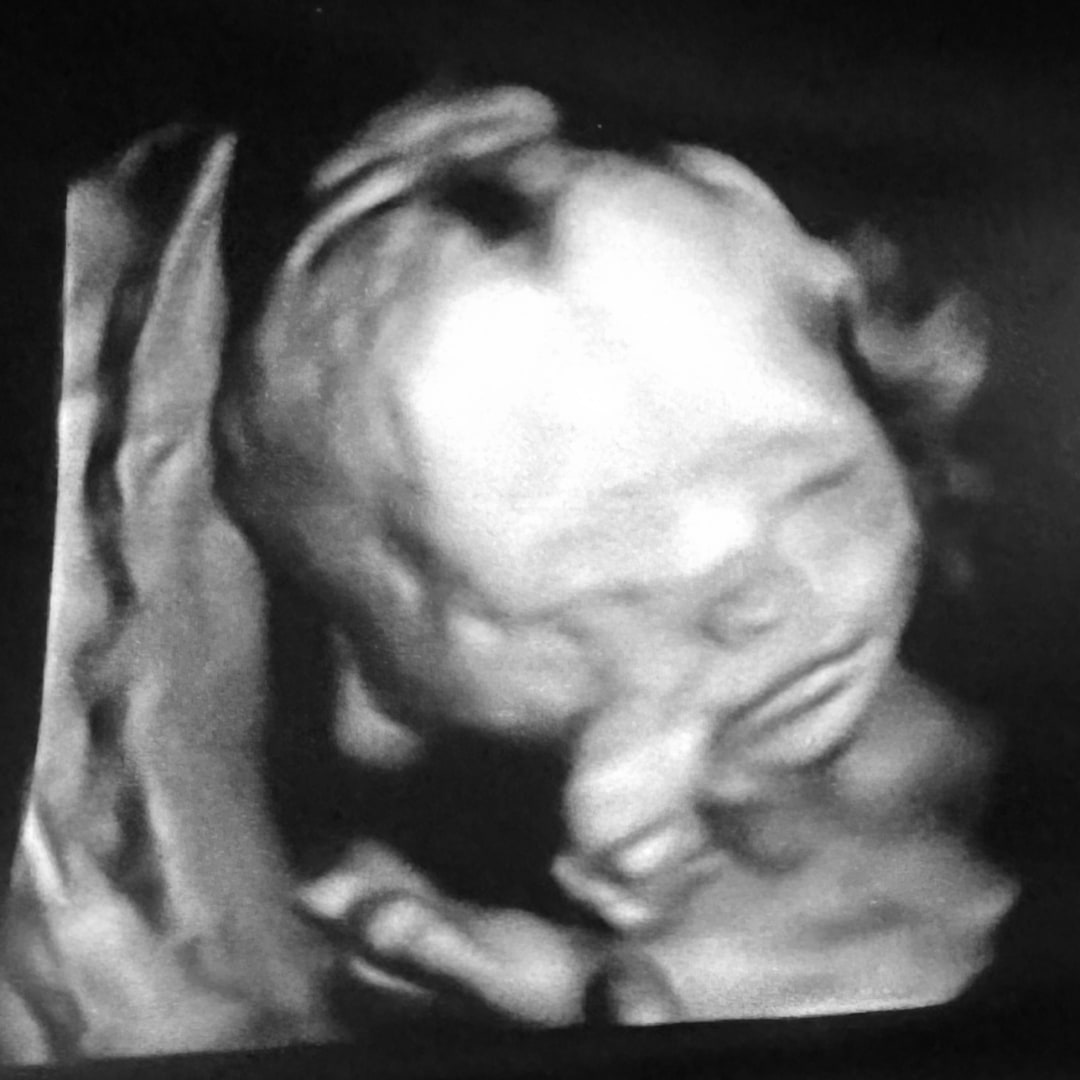 Photo shared by Chasity for their Babylist baby registry.