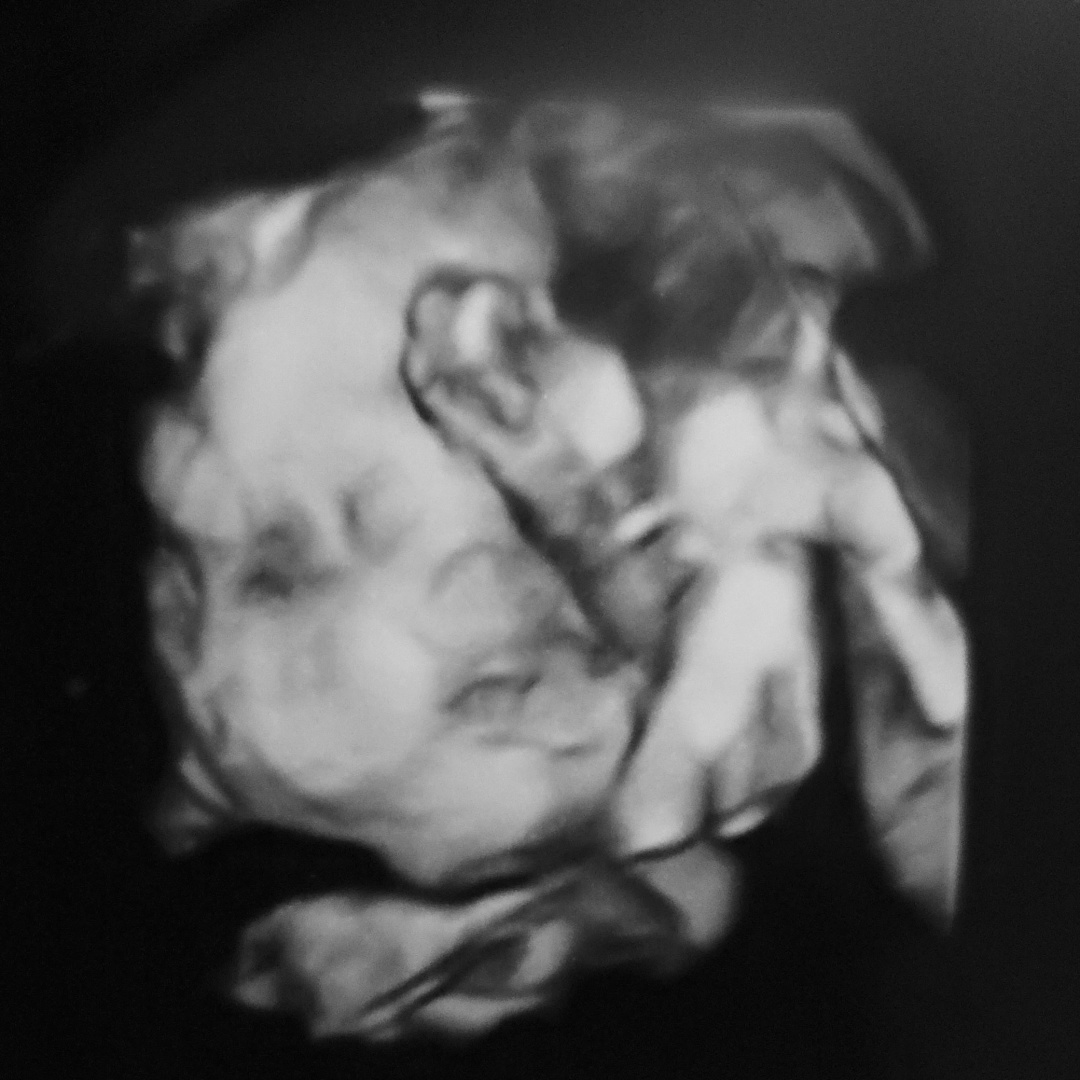 Photo shared by Misty for their Babylist baby registry.