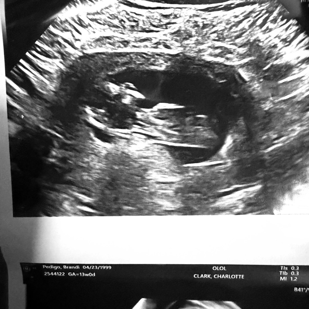 Photo shared by Brandi for their Babylist baby registry.
