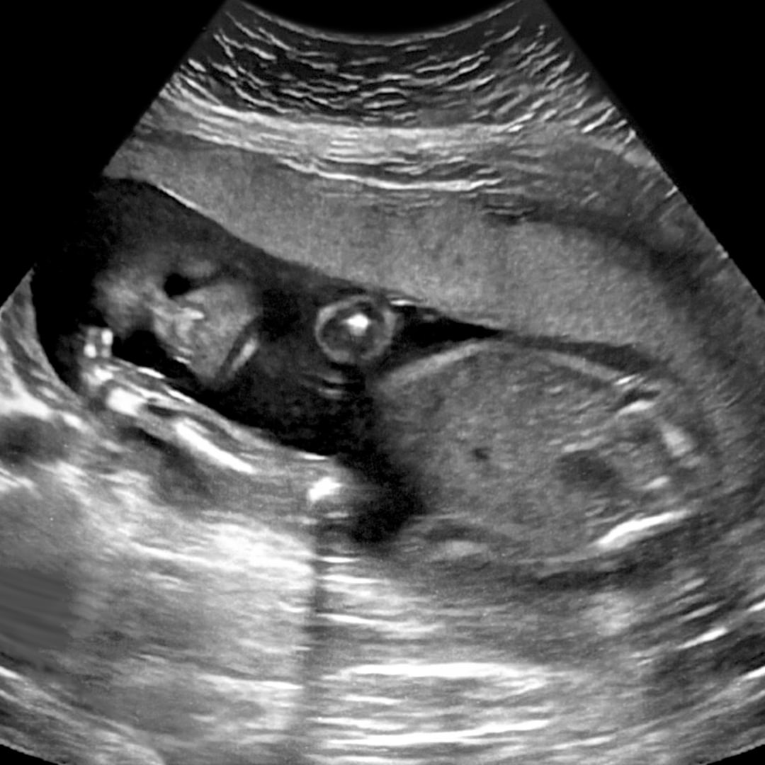 Photo shared by Stephanie for their Babylist baby registry.
