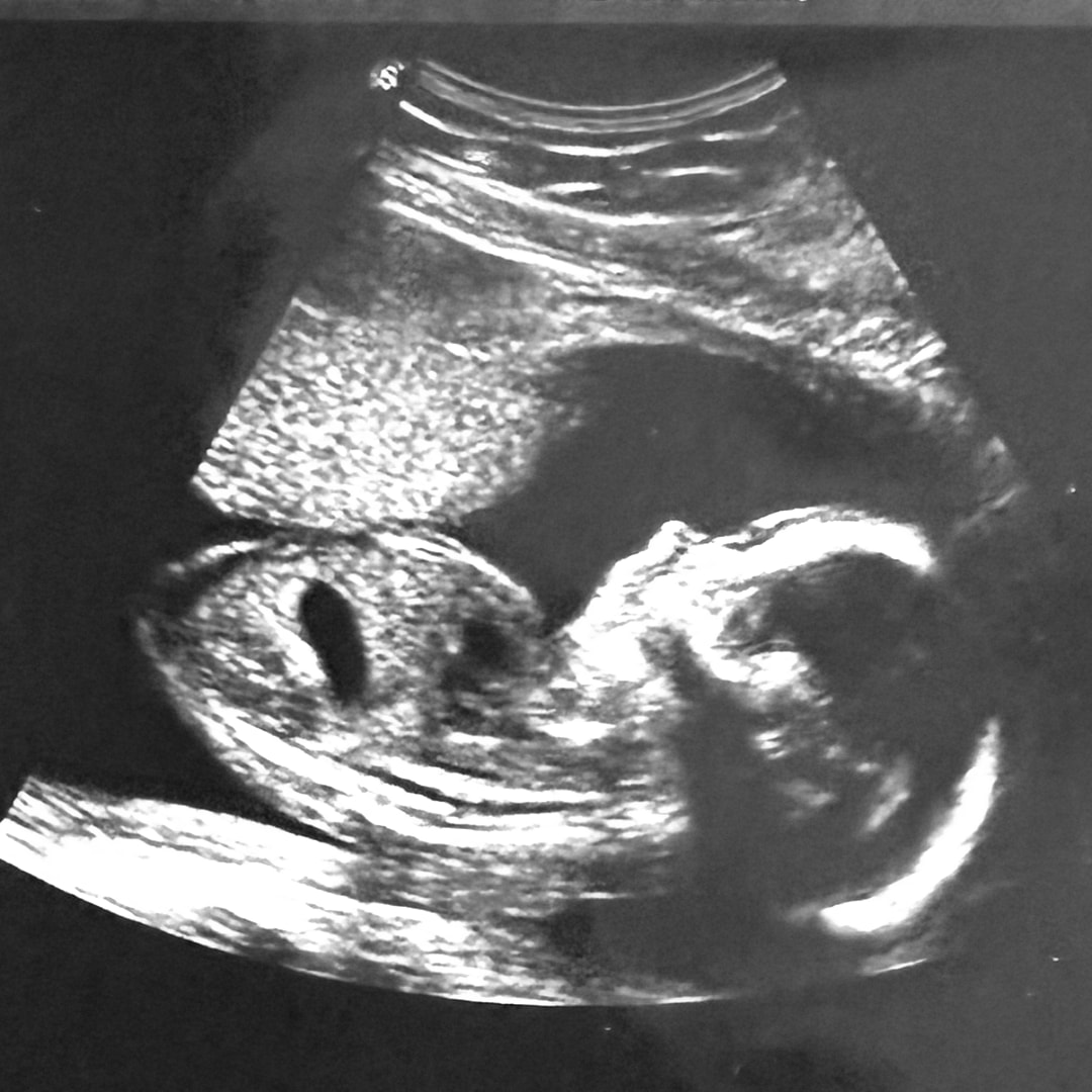 Photo shared by Alana for their Babylist baby registry.