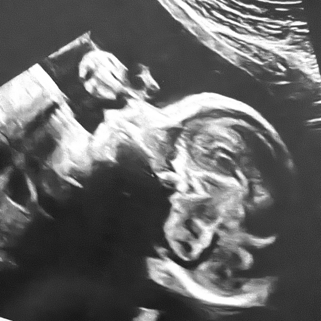 Photo shared by Adda & Devonte for their Babylist baby registry.