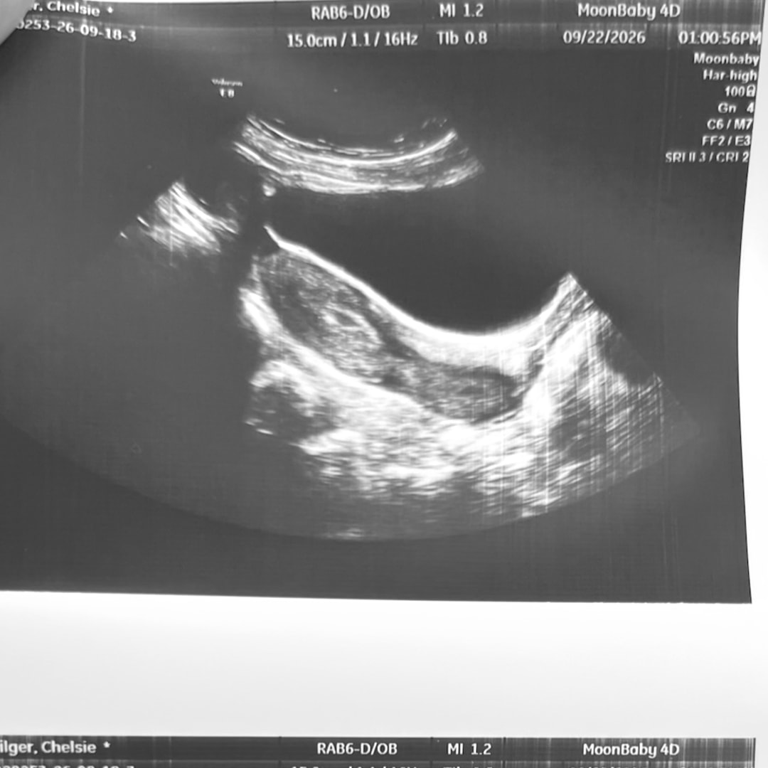 Photo shared by Chelsie for their Babylist baby registry.