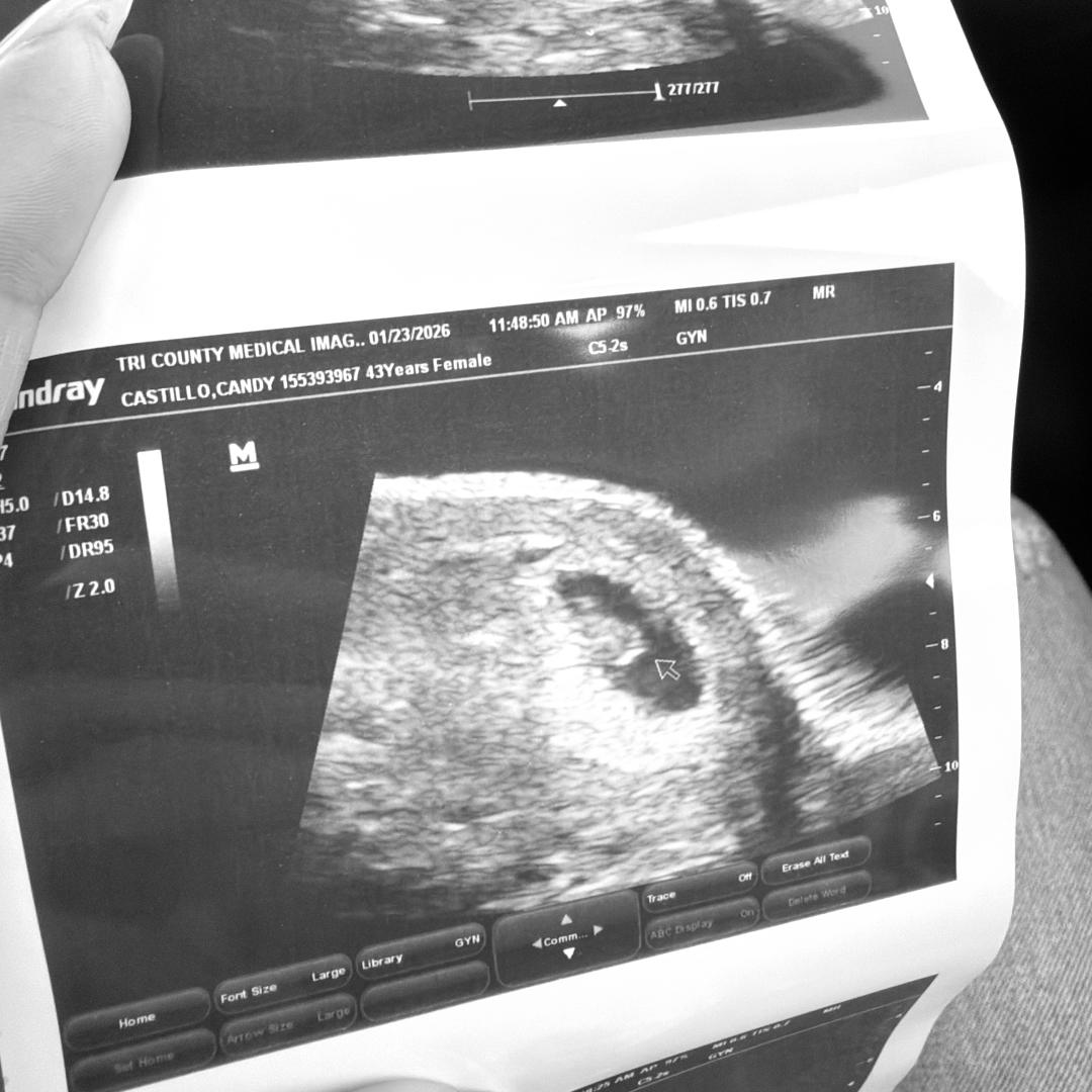 Photo shared by Candy for their Babylist baby registry.