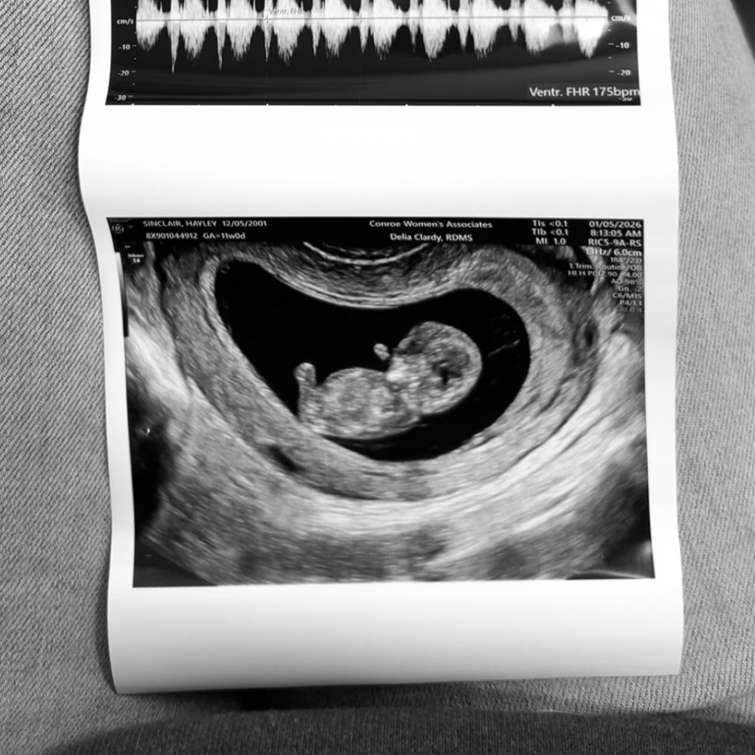 Photo shared by Hayley for their Babylist baby registry.