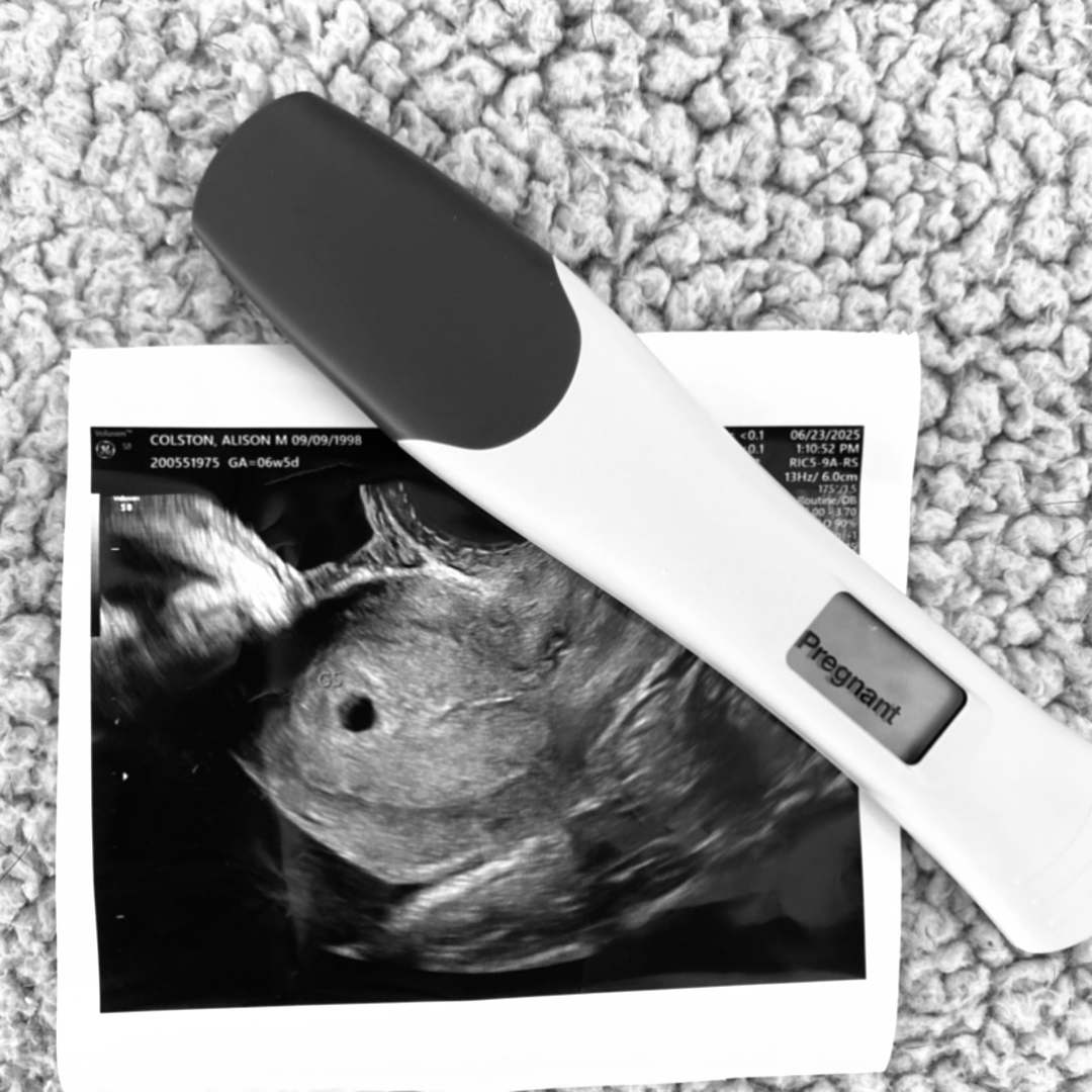 Photo shared by Alison for their Babylist baby registry.