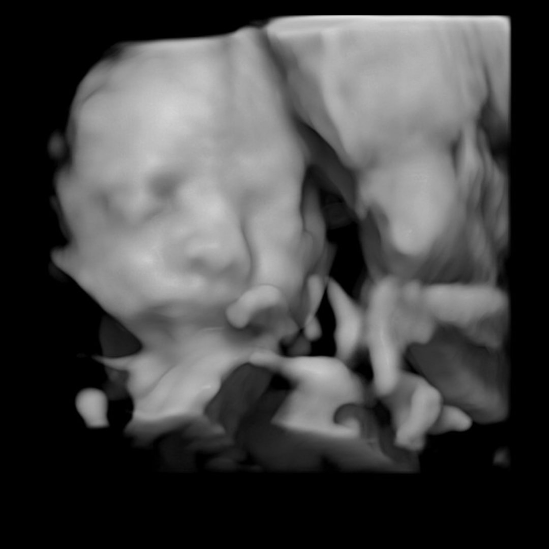 Photo shared by Madison for their Babylist baby registry.