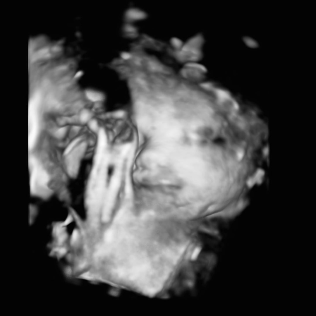 Photo shared by Haley for their Babylist baby registry.